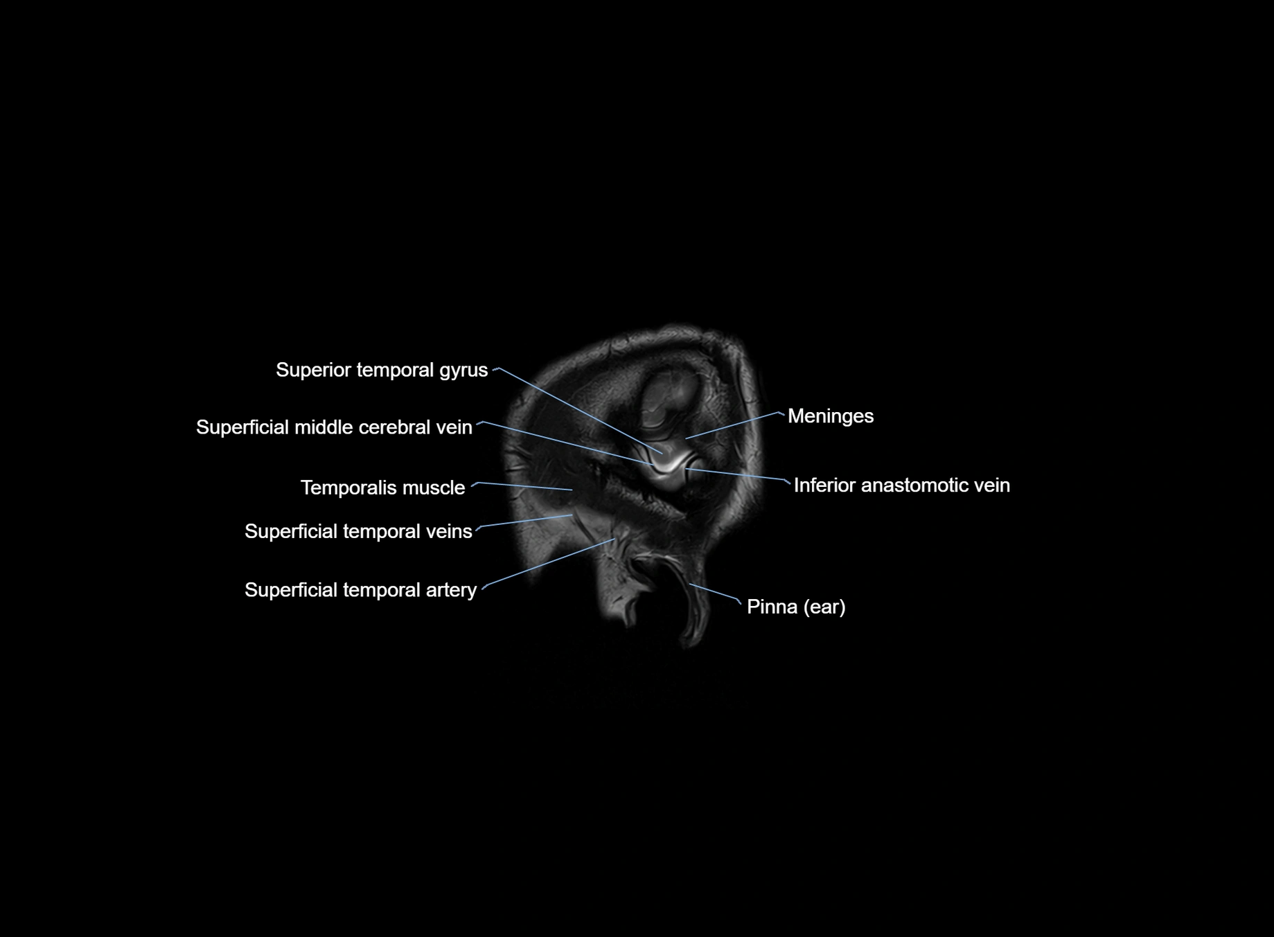 brain sagittal anatomy 3T MRI images -img-00001-00003.webp